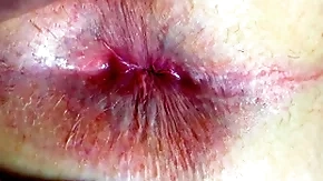 Bore added to anus closeup